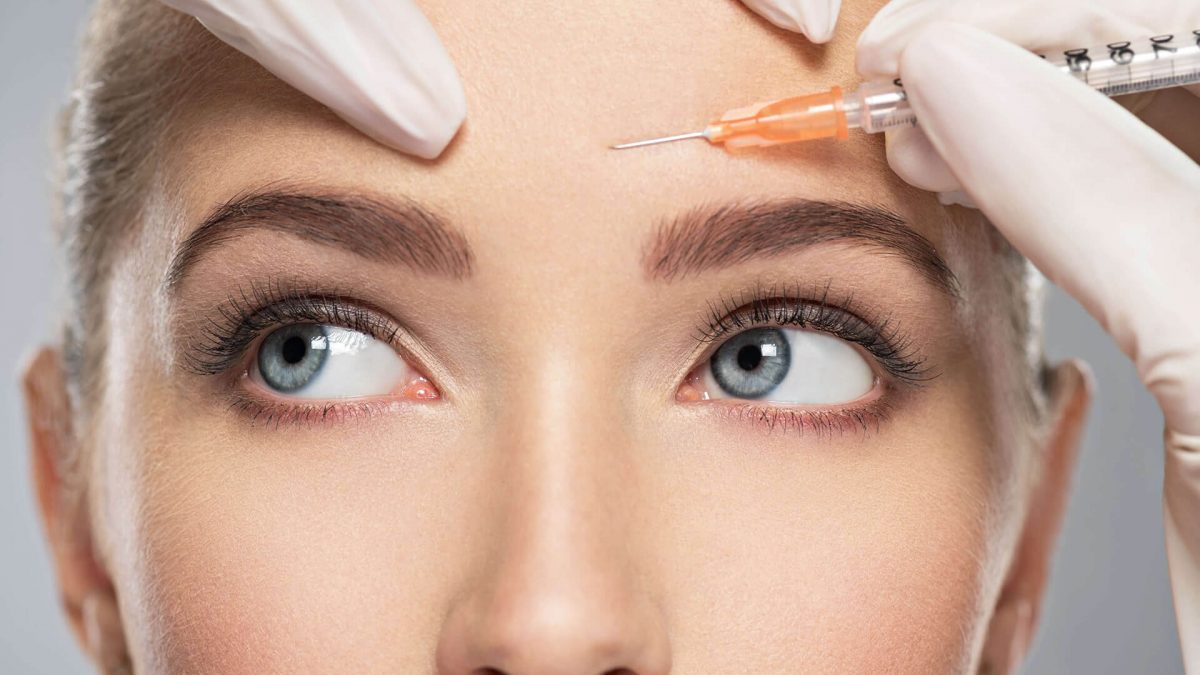 Botox Preventivo